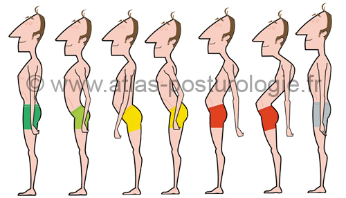posturologie-postures